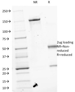 VEGF Antibody (VEGF/1063), Novus Biologicals 0.2mg; Unlabeled:Antibodies,